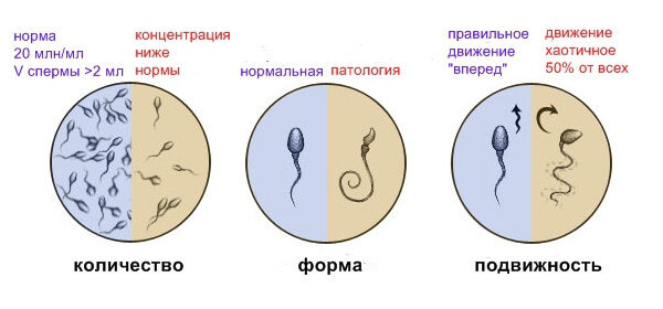 Пять здоровых привычек для улучшения качества сперматозоидов — Блог Reprolife