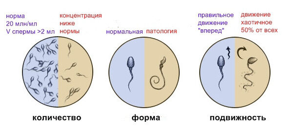 Как улучшить качество спермограммы быстро и результативно