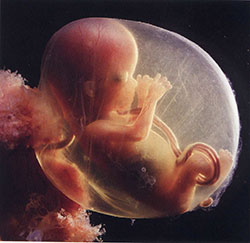 foetus-15semaines.jpg