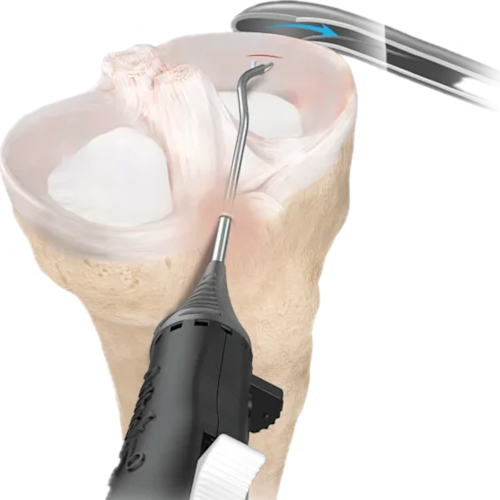 Advantages of joint arthroscopy