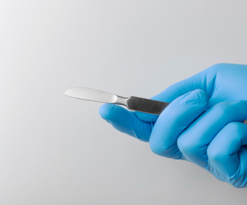 Что такое резекция желудка