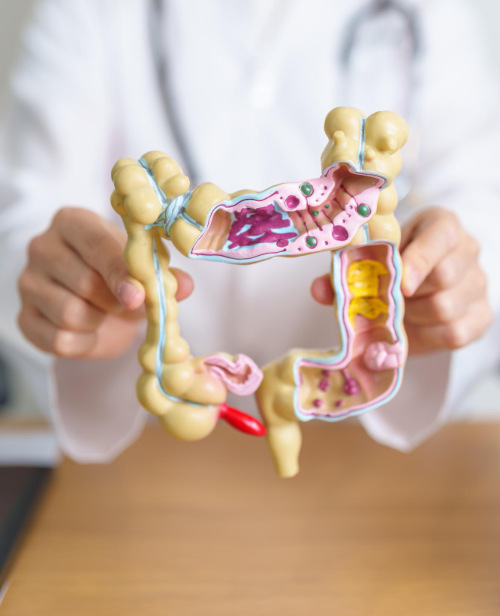 Types of intestinal diseases