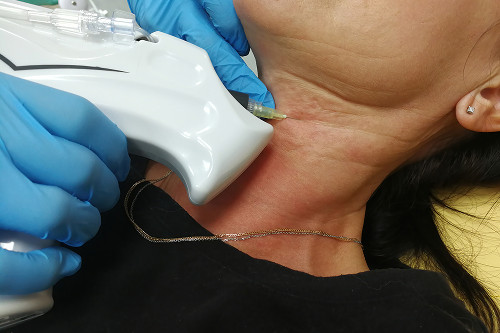 Ультразвуковая диагностика узла щитовидной железы