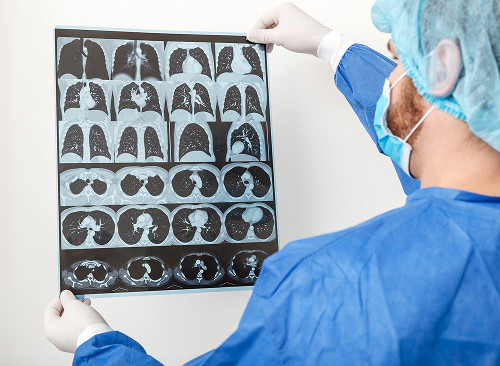 What does a thoracic surgeon treat?