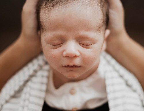 Общая информация о кефалогематоме