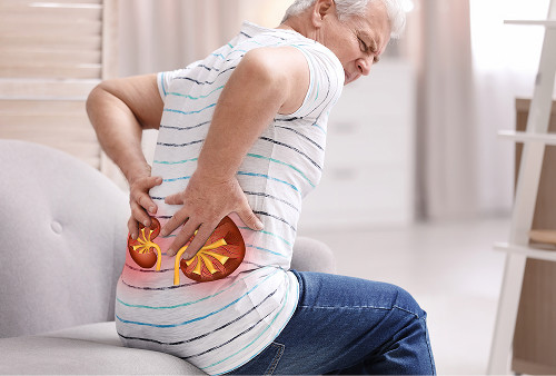 Anatomical image of the kidneys with visualization of stone formation in urolithiasis