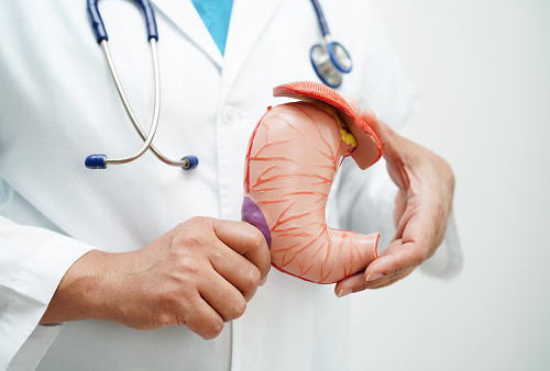 Definition of appendectomy