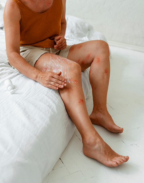 Definition and classification of trophic ulcers