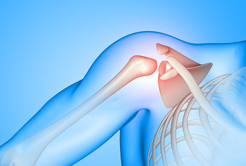 Общие сведения о переломах плеча