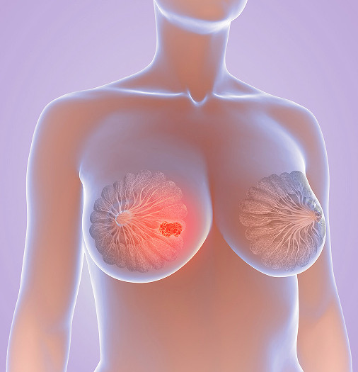 Воспалительные патологии 
