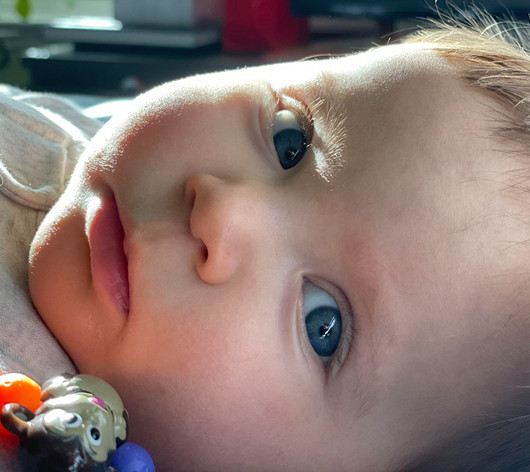 Что такое зондирование слезного канала