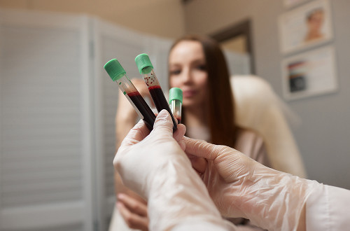 Preparation for the procedure