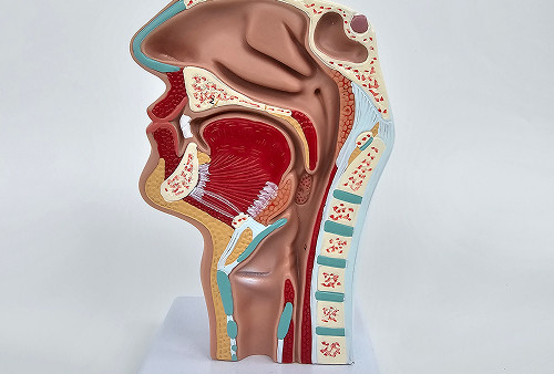 Gonococcal pharyngitis