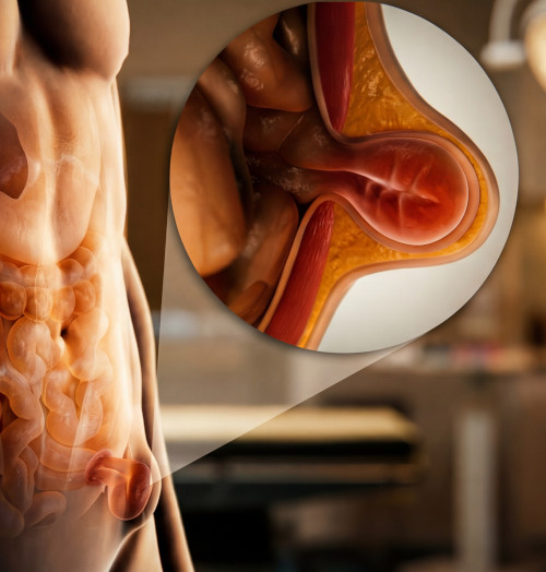 Why is it important to see a hernia specialist in a timely manner?