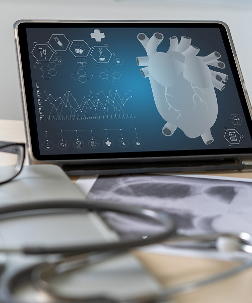 What is echocardiography?