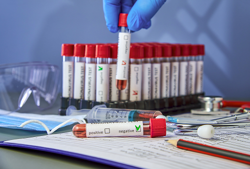 Какие анализы сдают на гепатит