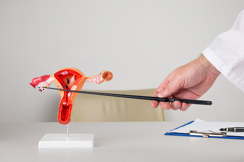 Advantages of performing oophorectomy at the K+31 clinic