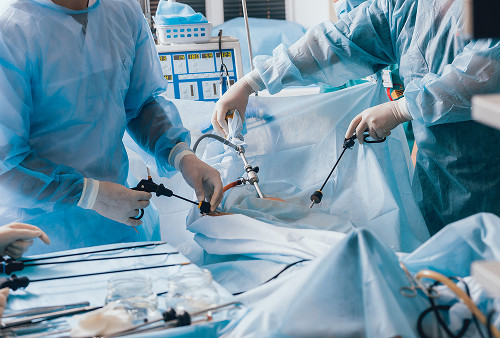 Advantages of laparoscopic surgery