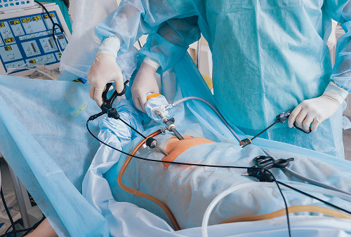 How is laparoscopy performed for an ovarian cyst