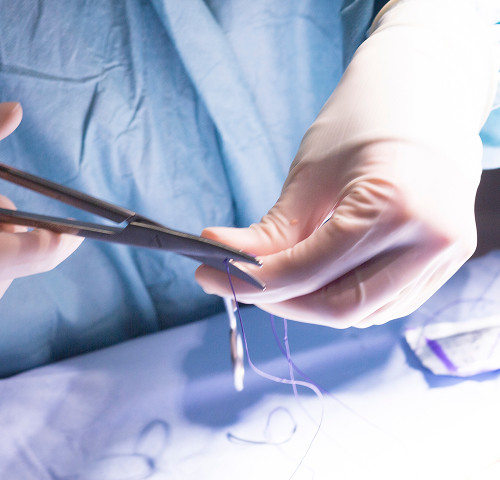 Лечение меланомы