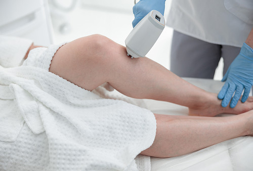 Эндовенозная лазерная облитерация (ЭВЛО)