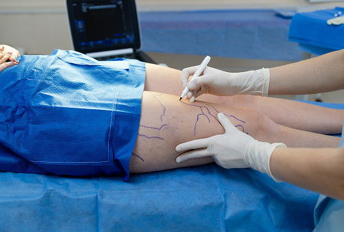 Ультразвуковая навигация во время операции