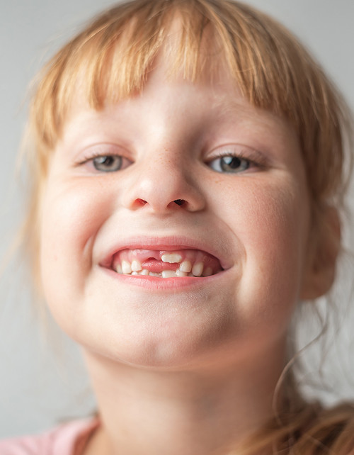 When is treatment by a pediatric orthodontist necessary?