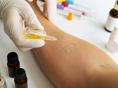 An immunologist consults with a young patient with allergies, using safe diagnostic methods.