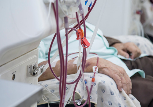 The role of hemodialysis in severe conditions