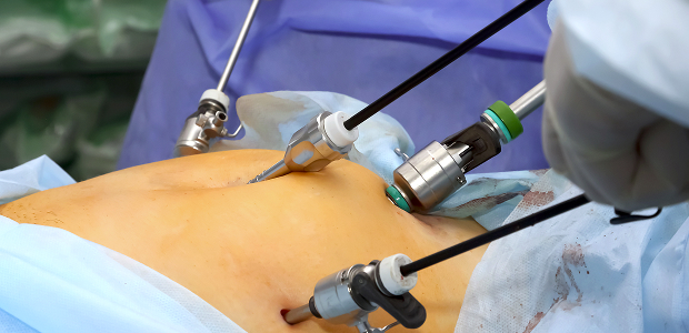 Как проходит процесс установки: этапы и подготовка