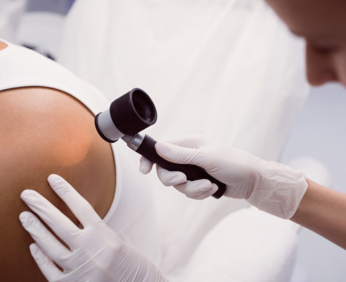 Features of the course of melanoma at stage IV