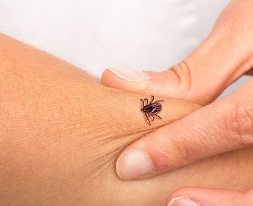 Why is hospitalization necessary after a tick bite?