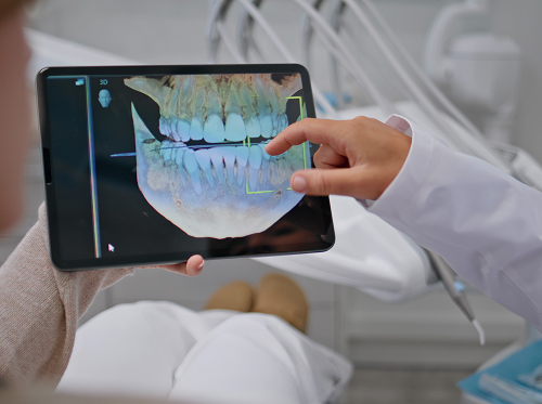 Диагностика перекрёстного прикуса