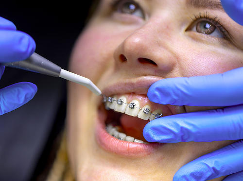 Методы исправления перекрёстного прикуса