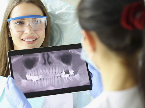 Чем опасна гранулема без лечения