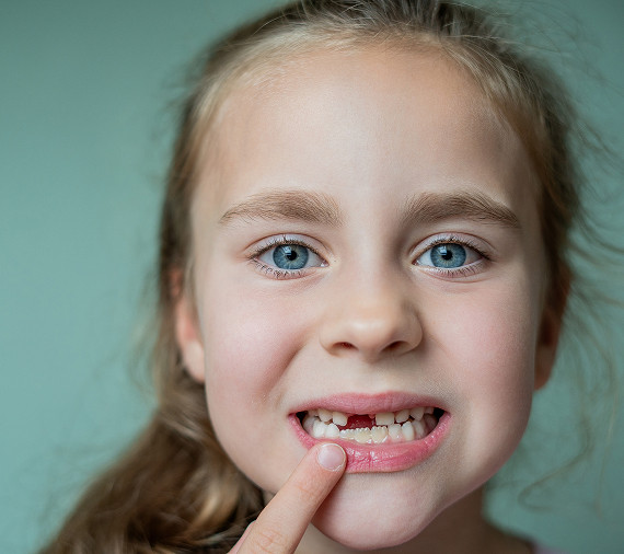 Адентия у детей