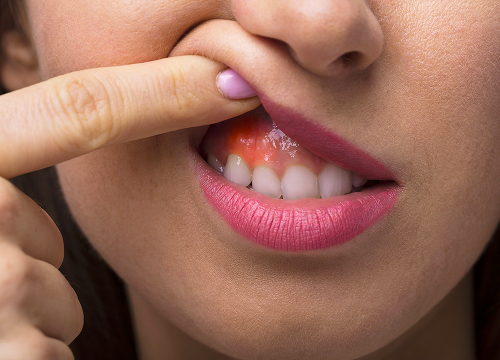 Что относится к травмам зубов