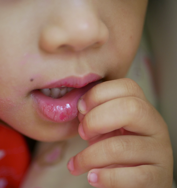 Причины и факторы риска