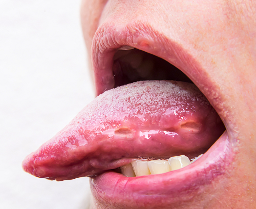 Когда нужно обратиться к врачу