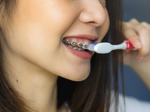 Что нельзя делать при катаральном стоматите