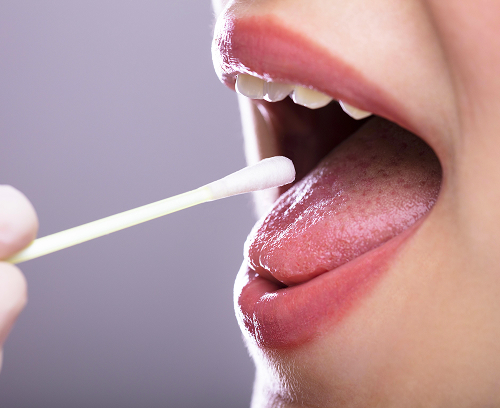 Лечение афтозного стоматита