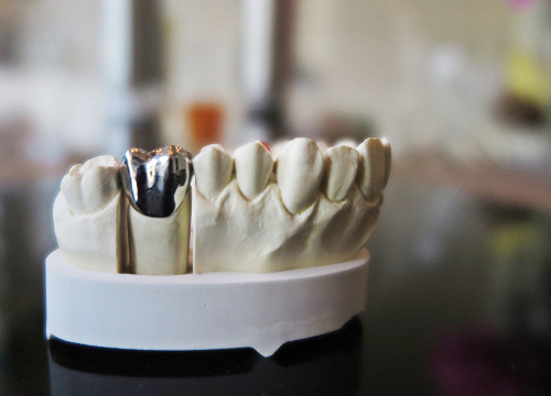 Causes and risk factors