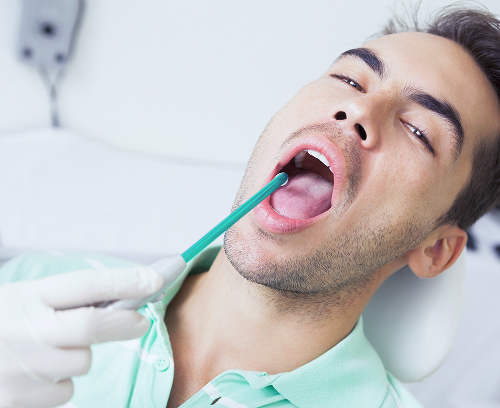 Виды глоссита