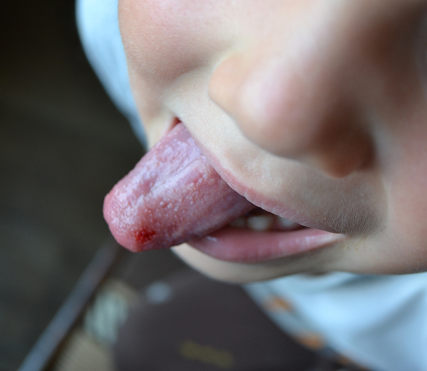 Причины кандидоза и факторы риска