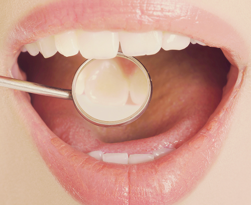 Основные формы кандидоза