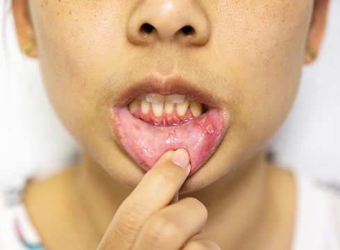 Причины и факторы риска