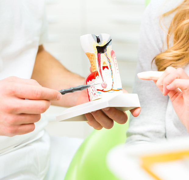 What is deep caries?