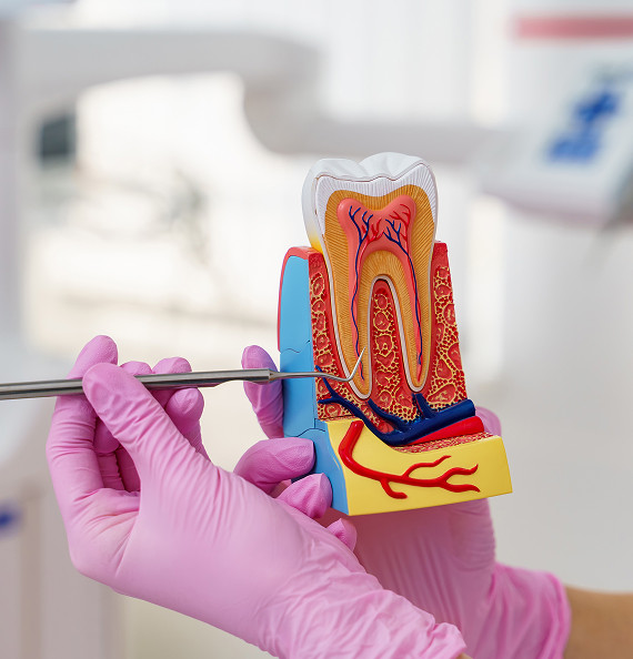 What happens if deep caries is not treated?