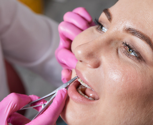 Diastema in children and adults