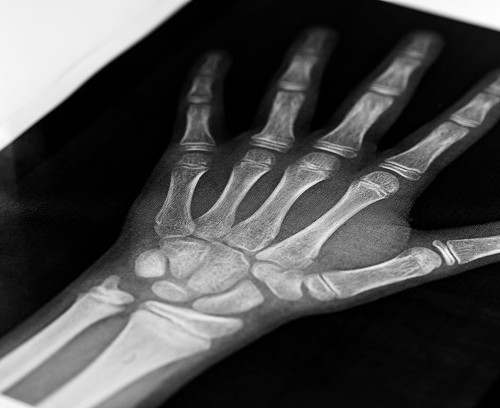 Diagnosis by a Pediatric Orthopedic Traumatologist